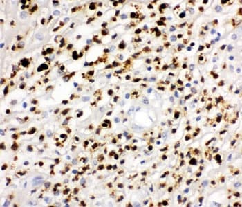 MPO / Myeloperoxidase Antibody (aa406-745)