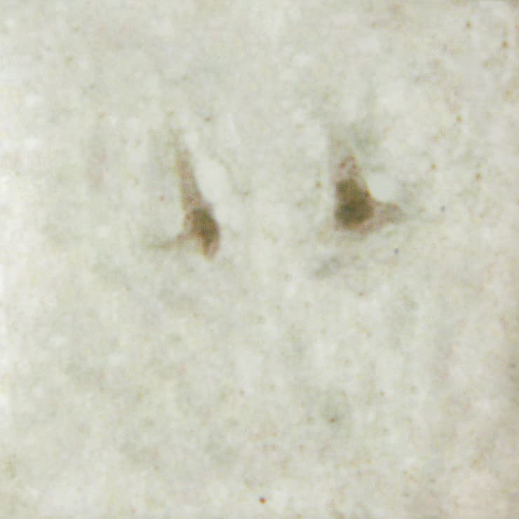 SP1 Antibody (phospho-Thr453)