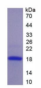 Human PGF / PLGF Protein (Recombinant His-T7)