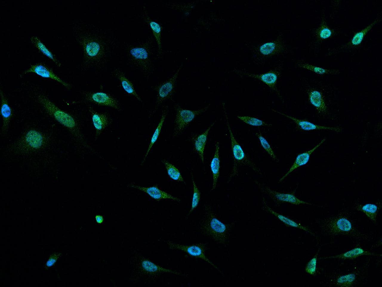 E6AP / UBE3A Antibody