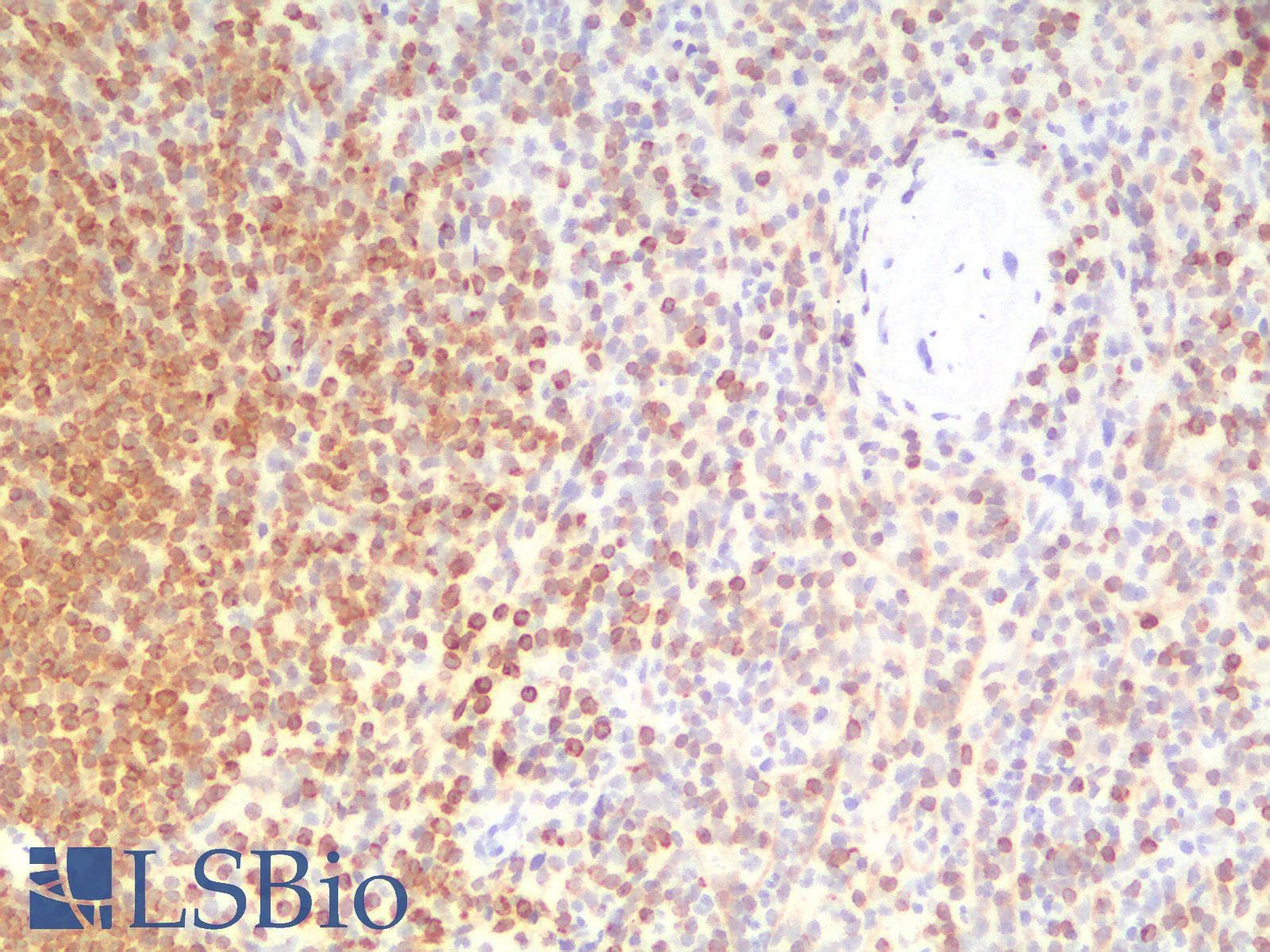 PathPlus™ BCL2 / Bcl-2 Antibody (clone BCL2/1878R)