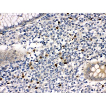 MMP8 Antibody (aa119-153)