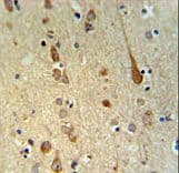 FAAH2 Antibody (aa409-438)