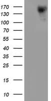 ERBB2 / HER2 Antibody (aa676-1255, clone OTI11A7, Carrier-free)