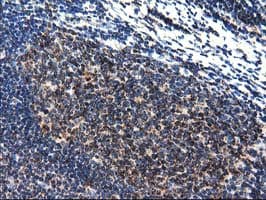 CLPP Antibody (clone OTI1G9)