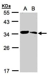 MMACHC Antibody (aa1-218)