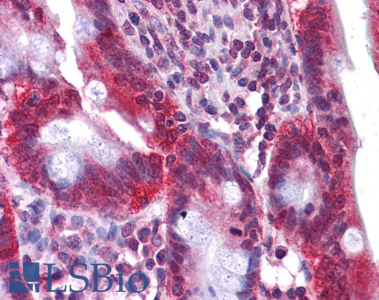 HNF4A / HNF4 Antibody (C-Terminus)