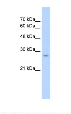 GLS2 / Glutaminase 2 Antibody (aa241-290)