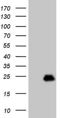 TCAP / Telethonin Antibody (clone OTI1A7)