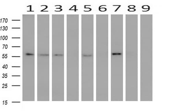 PPAT Antibody (aa42-278, clone OTI1B8)