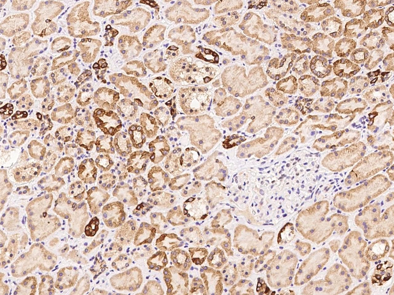 Polyclonal Rabbit anti-Human AHCTF1 / ELYS Antibody (IHC, IF)