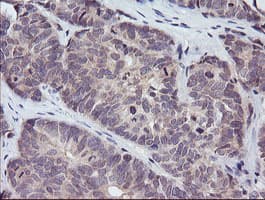 PIK3R5 Antibody (clone OTI2A6)