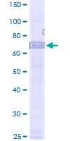 Human AIM2 Protein (Recombinant GST)