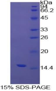 Bovine TTR / Transthyretin Protein (Recombinant His)