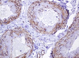 ABCB1 / MDR1 / P Glycoprotein Antibody (aa995-1280, clone OTI2G6, Carrier-free)