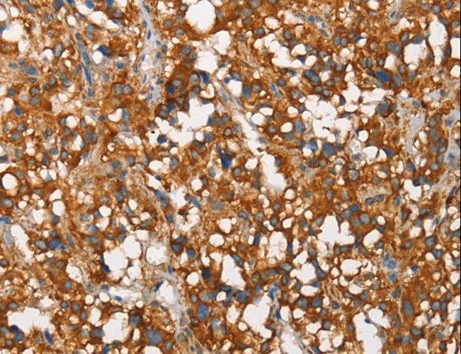 SNCA / Alpha-Synuclein Antibody