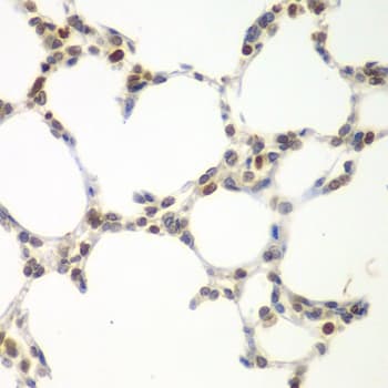 VRK1 Antibody