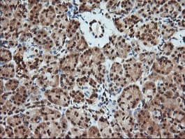 Monoclonal Mouse anti-Human MAP2K1 / MKK1 / MEK1 Antibody (clone OTI3E6, IHC, IF, WB)