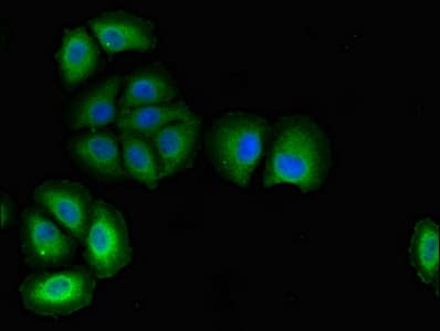 PODXL / Podocalyxin Antibody