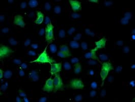 PFKP Antibody (clone OTI3G8, Carrier-free)