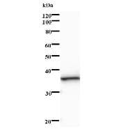 NTHL1 Antibody (clone 2660C1a)