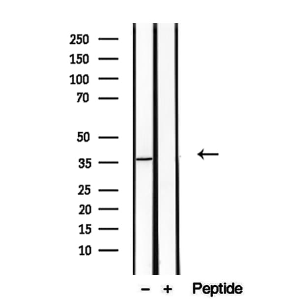 TOMM40 / TOM40 Antibody