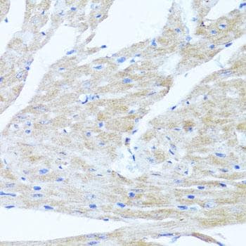 ULK1 Antibody