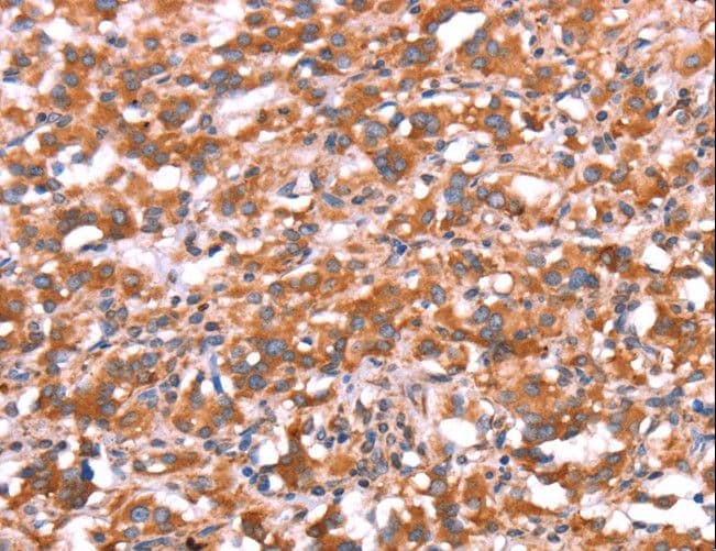 Polyclonal Rabbit anti-Human GAS8 Antibody (IHC)