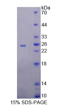 Human RNASE9 Protein (Recombinant His-T7)