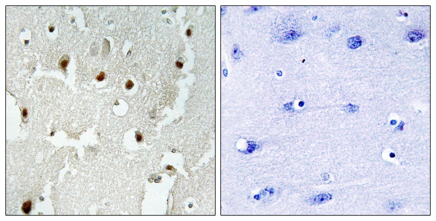 TRERF1 Antibody