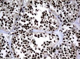 PCNA Antibody (clone OTI6A10)