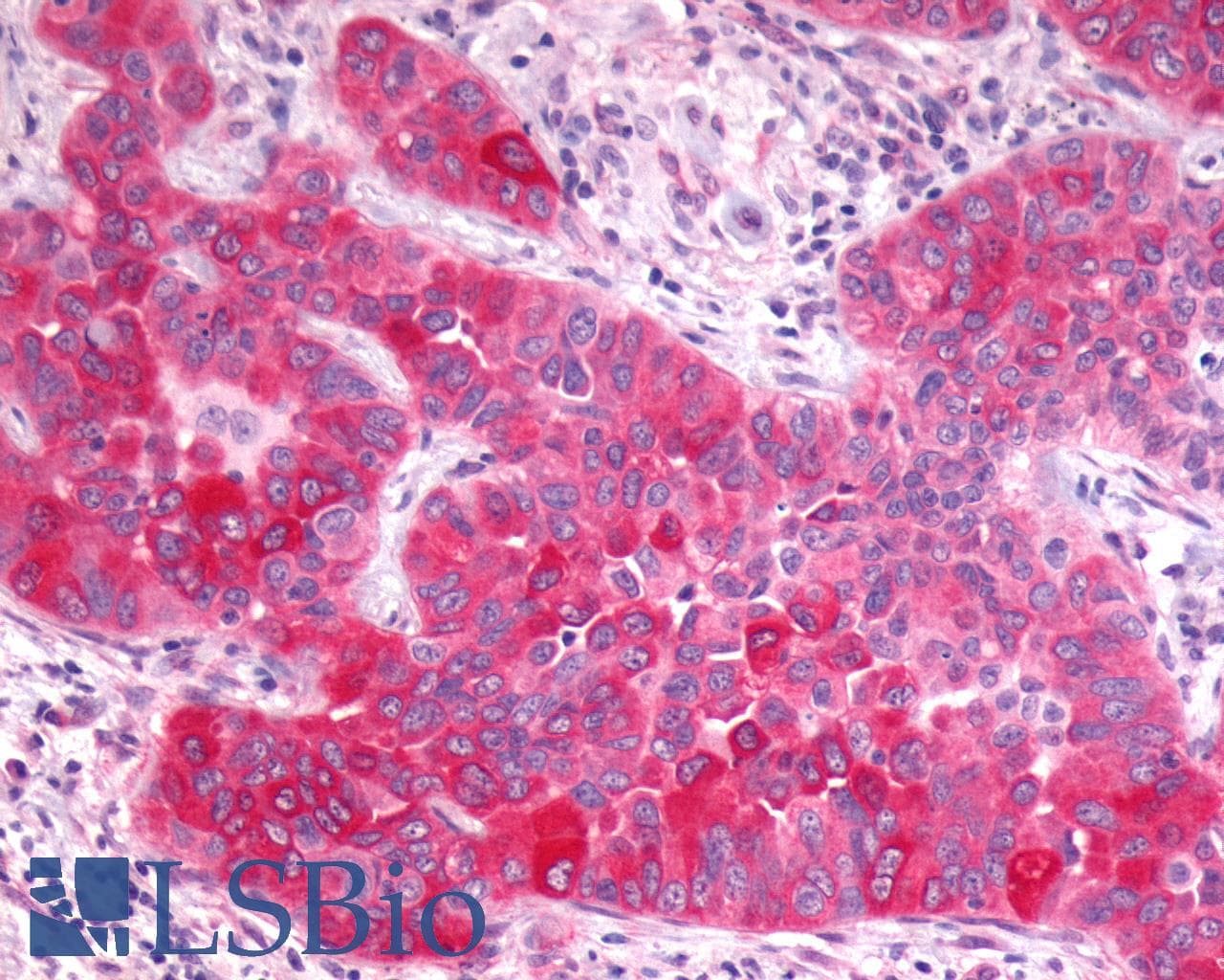 PathPlus™ Polyclonal Rabbit anti-Human GPR17 Antibody (N-Terminus, IHC)