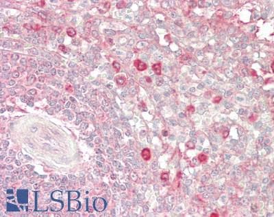 IHC-plus™ TAX1BP1 Antibody (aa739-789)