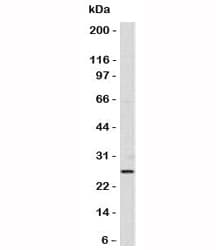 BCL2 / Bcl-2 Antibody (aa41-54, clone SPM530)