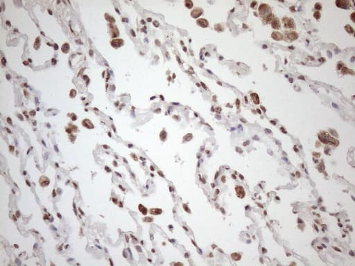 EXOSC1 / CSL4 Antibody (clone OTI4B7)