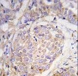 Polyclonal Rabbit anti-Human MAGE10 / MAGEA10 Antibody (aa324-353, IHC, WB)