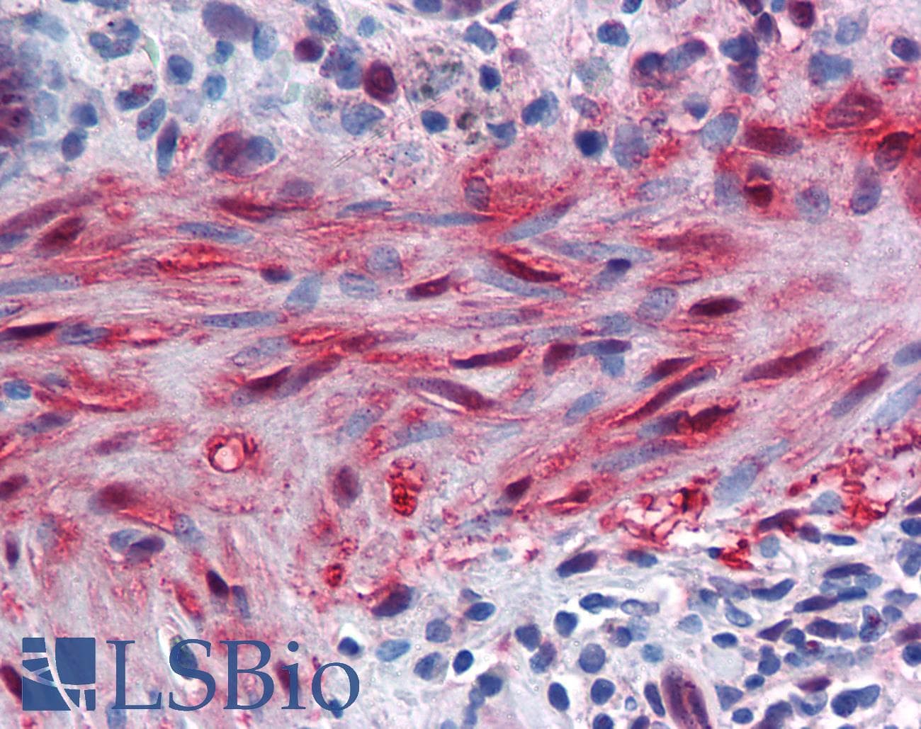 IHC-plus™ YAP / YAP1 Antibody (clone 2H1)
