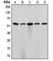 CYP17 / CYP17A1 Antibody (Internal)