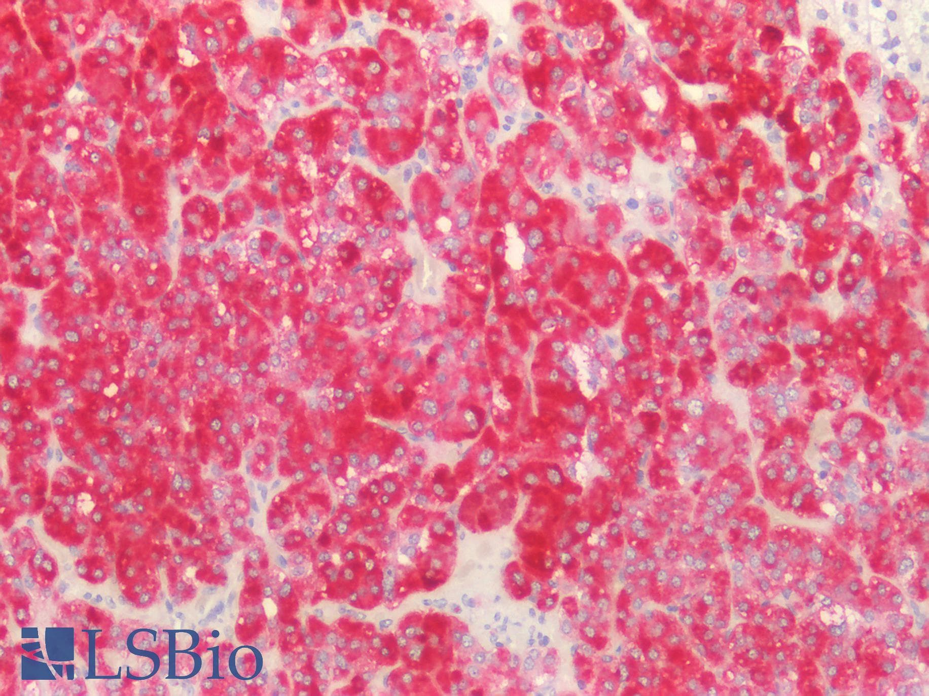 PathPlus™ Polyclonal Rabbit anti-Human TGFB2 / TGF Beta2 Antibody (N-Terminus, IHC)