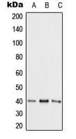 ADK / Adenosine Kinase Antibody (N-Terminus)