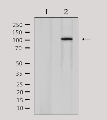 Polyclonal Rabbit anti-Human CDCA2 Antibody (IF, WB)