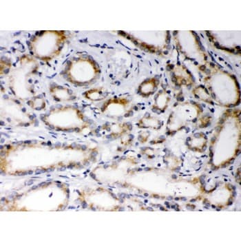 EBAG9 / RCAS1 Antibody (aa31-213)