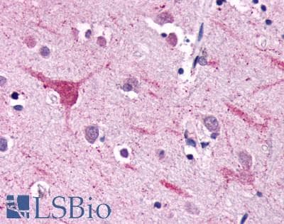IHC-plus™ NPFF2 / NPFFR2 Antibody (Extracellular Domain)