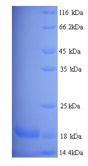 Mouse Mup8 + Mup11 Protein (Recombinant)