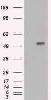 IFT57 / HIPPI Antibody (clone OTI5B6)