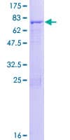Human ACTL7A Protein (Recombinant GST)