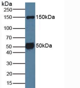 SGK1 / SGK Antibody (aa145-386)