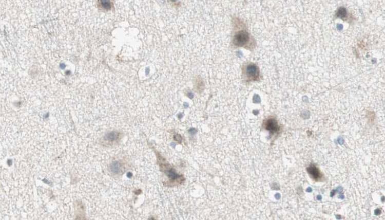 ABCC3 / MRP3 Antibody
