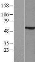 ZIK1 Protein (Over-Expression Lysate Myc-DDK (Flag))