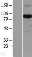 AFAP1 / AFAP Protein (Over-Expression Lysate Myc-DDK (Flag))